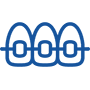 Invisalign-Clear-Braces