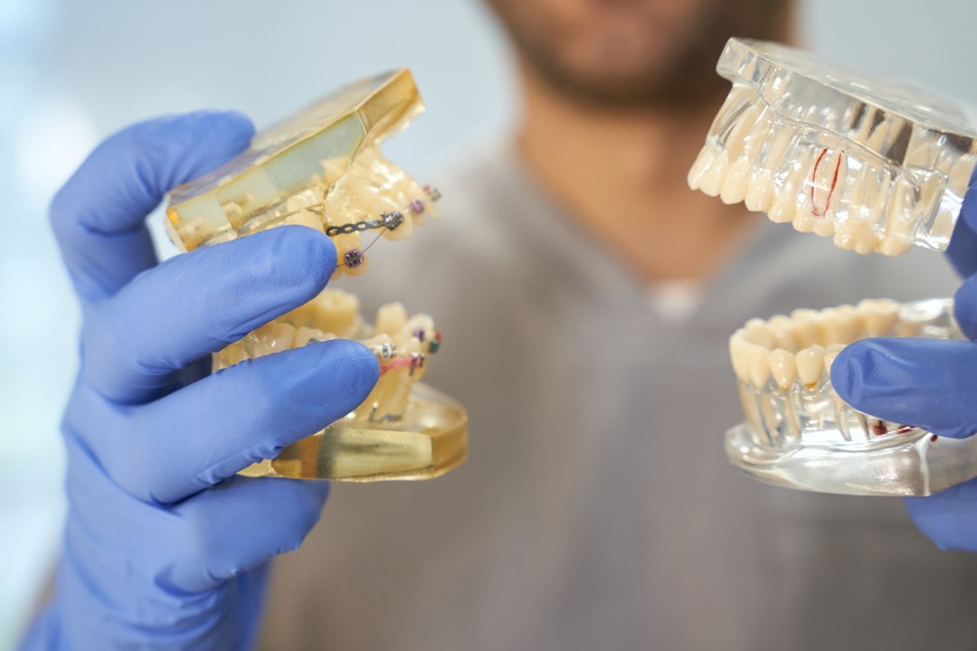 Dental Implants Mississauga