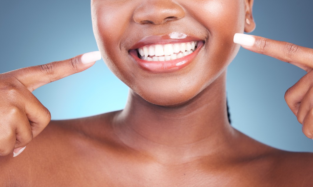 Teeth Whitening Mississauga