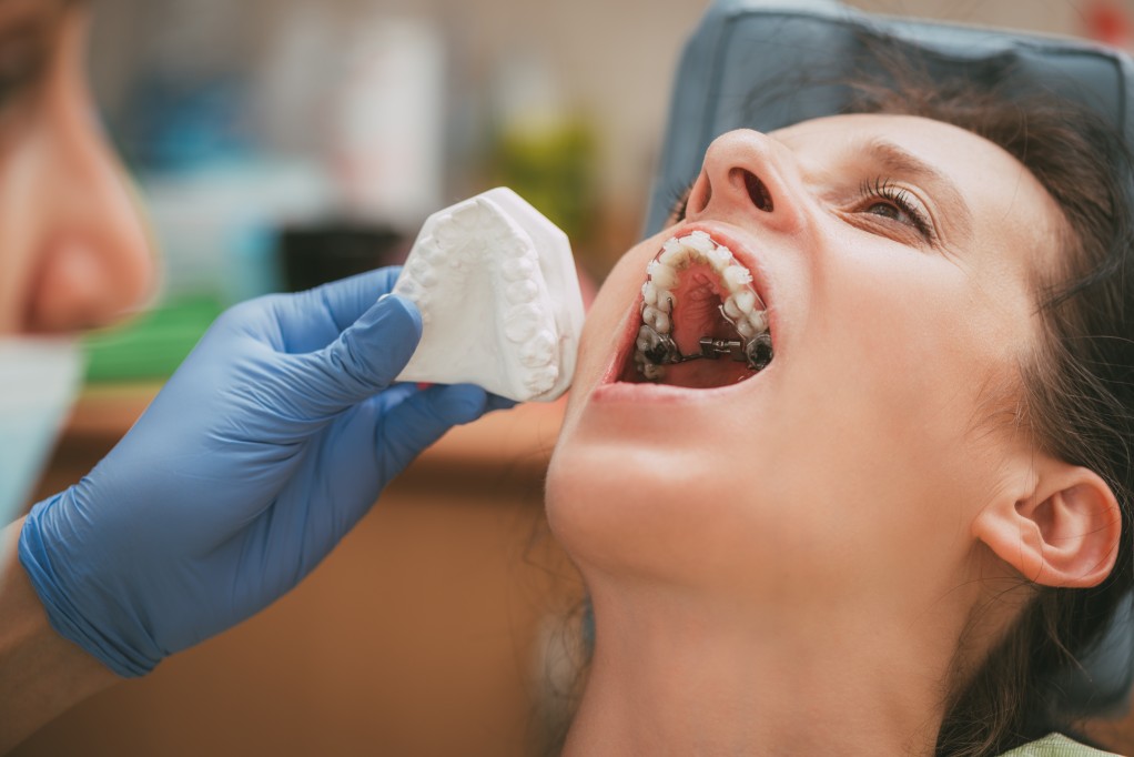 teeth whitening in Mississauga