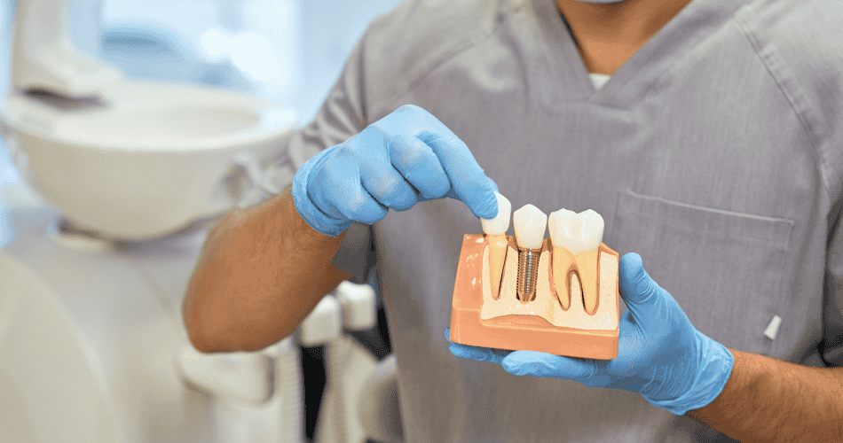 dental implant cost
