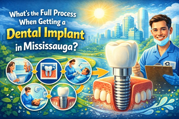 a dental implant in Mississauga